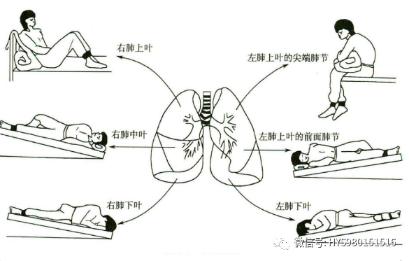 慢阻肺-痰多-咳痰-排痰-氣道廓清-康復-肺病-呼吸-肺功能檢測儀