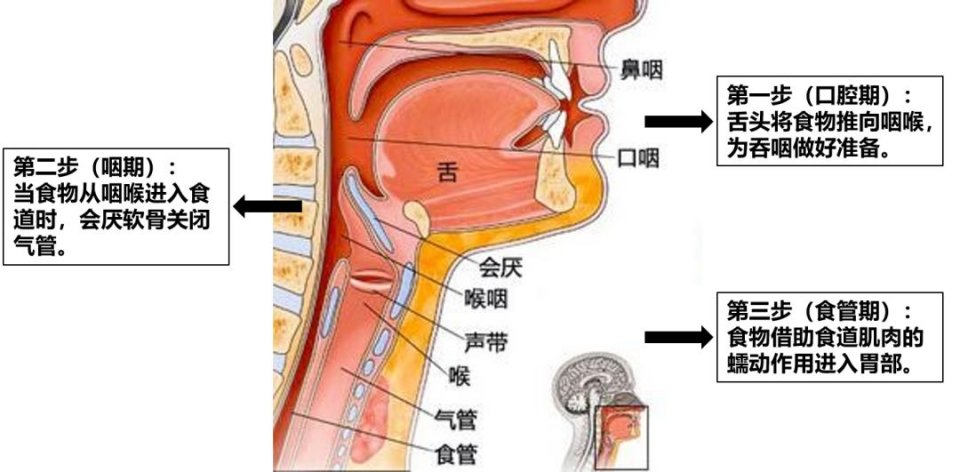 吞咽-吞咽障礙-吃飯-進(jìn)食困難-嗆咳-咳嗽-咳痰-吸入性肺炎-呼吸肌-呼吸機-冷刺激治療-腹式呼吸-縮唇呼吸-呼吸訓練器-唾液吞咽-進(jìn)食體位管理-肺功能-肺功能檢測儀-肺炎-通氣